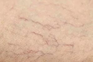 Estrelas vasculares