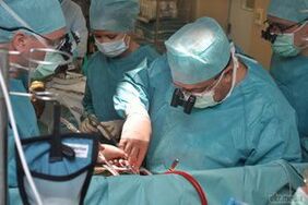 tratamento cirúrxico das varices pélvicas