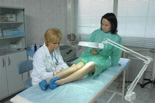 Terapia con láser para varices nas pernas