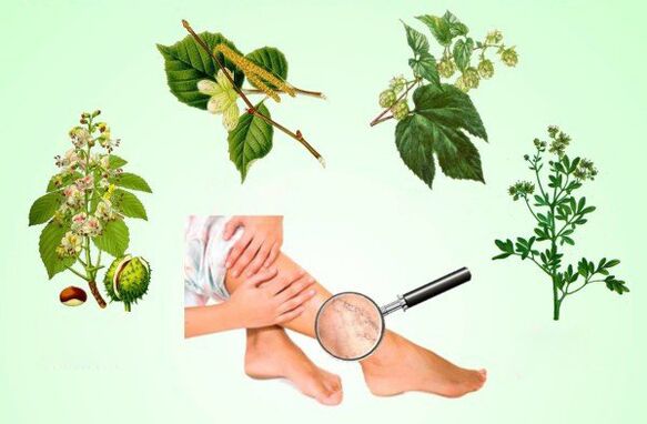 Herbas para o tratamento de varices nas pernas
