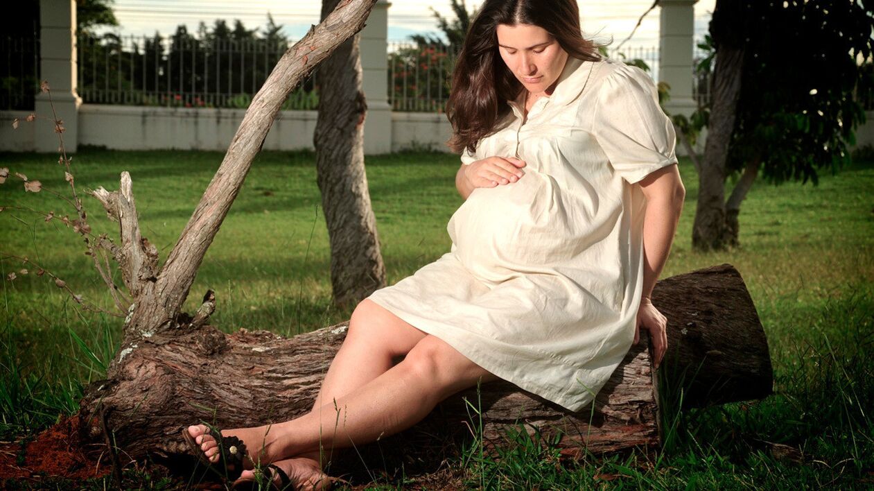O embarazo é un factor no desenvolvemento de varices nas pernas